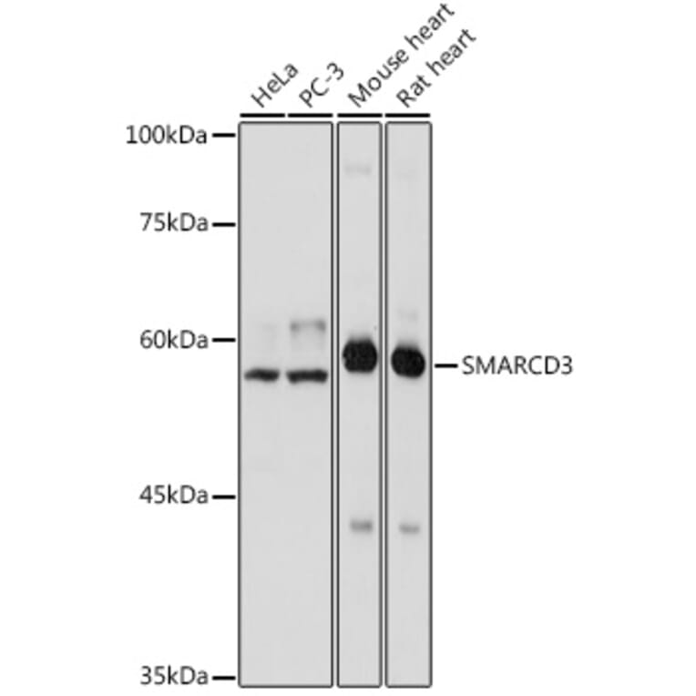 Western Blot - Anti-BAF60C Antibody (A306600) - Antibodies.com