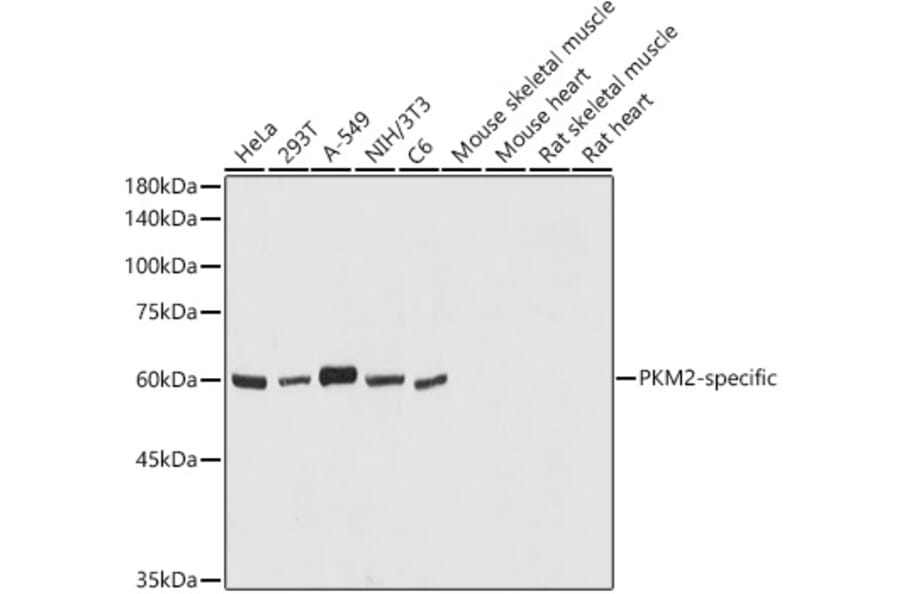Western Blot - Anti-PKM Antibody (A306602) - Antibodies.com