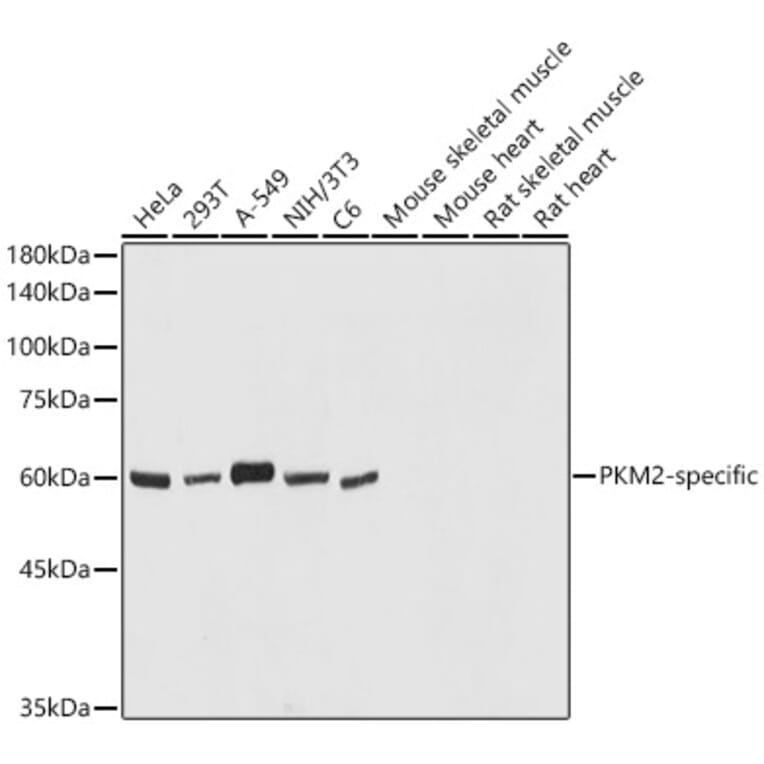 Western Blot - Anti-PKM Antibody (A306602) - Antibodies.com