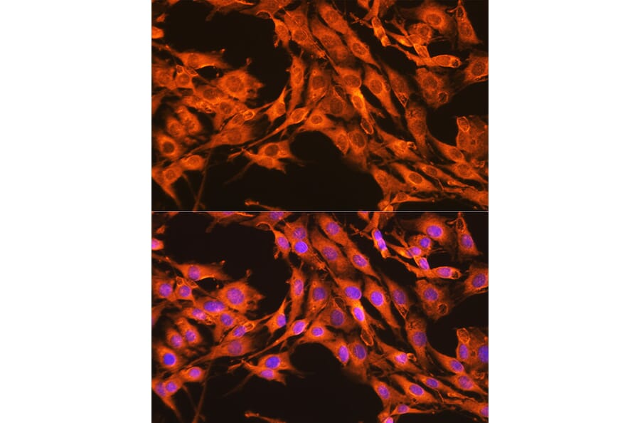 Immunofluorescence - Anti-PKM Antibody (A306602) - Antibodies.com