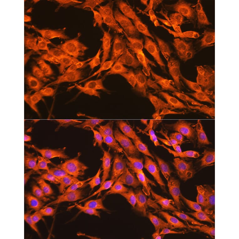 Immunofluorescence - Anti-PKM Antibody (A306602) - Antibodies.com