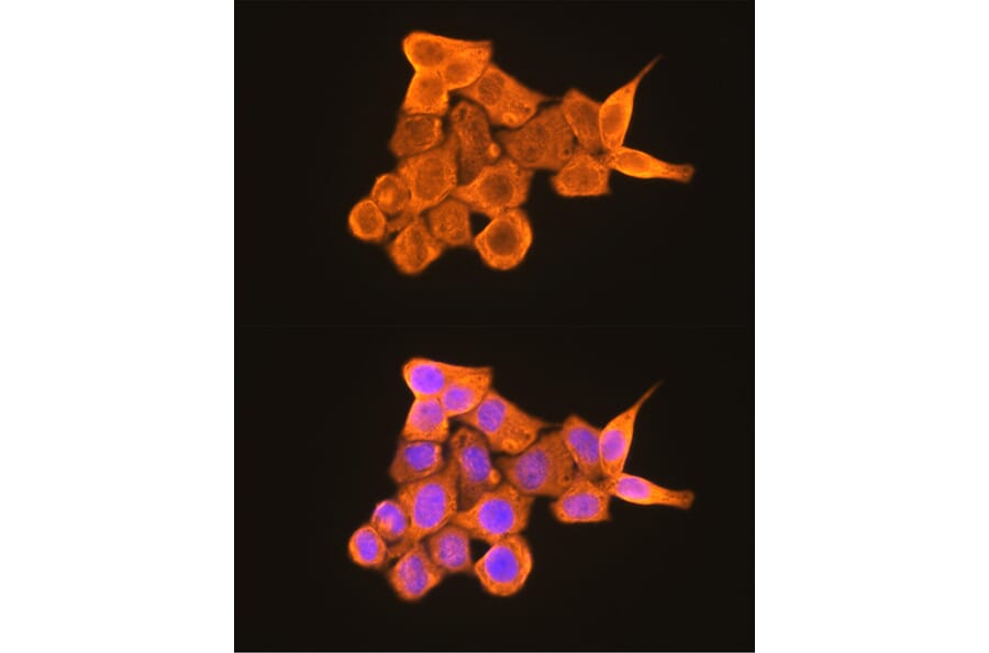 Immunofluorescence - Anti-PKM Antibody (A306602) - Antibodies.com
