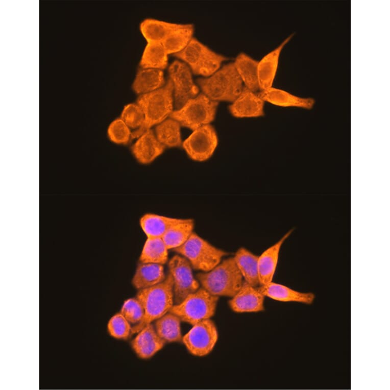 Immunofluorescence - Anti-PKM Antibody (A306602) - Antibodies.com