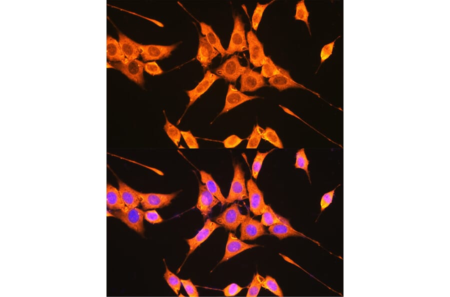 Immunofluorescence - Anti-PKM Antibody (A306602) - Antibodies.com