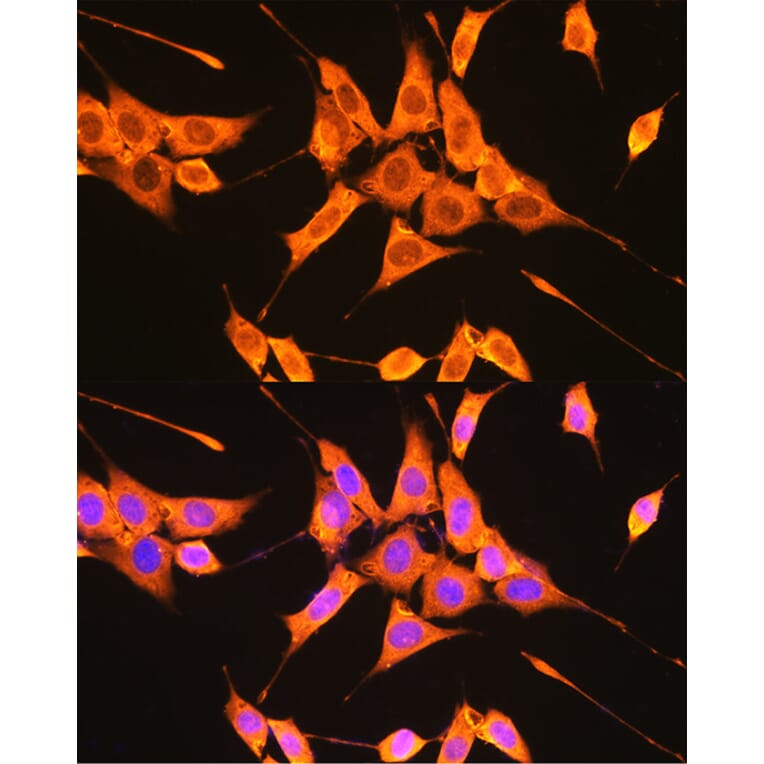 Immunofluorescence - Anti-PKM Antibody (A306602) - Antibodies.com