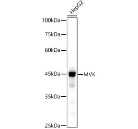 Western Blot - Anti-MVK Antibody [ARC2871] (A306603) - Antibodies.com