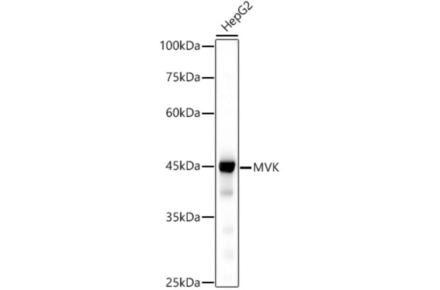 Western Blot - Anti-MVK Antibody [ARC2871] (A306603) - Antibodies.com