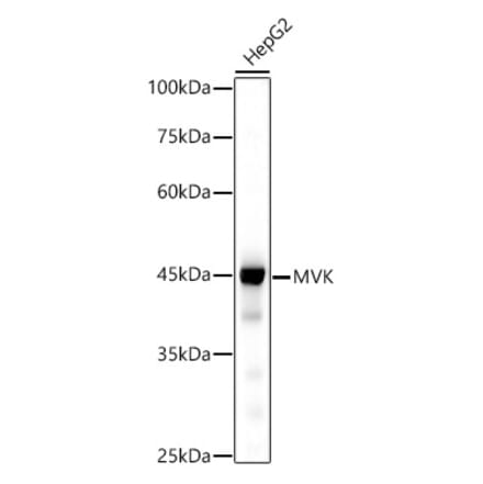 Western Blot - Anti-MVK Antibody [ARC2871] (A306603) - Antibodies.com