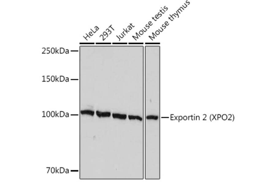 Western Blot - Anti-Cellular Apoptosis Susceptibility/CSE1L Antibody [ARC1856] (A306604) - Antibodies.com