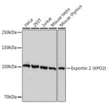 Western Blot - Anti-Cellular Apoptosis Susceptibility/CSE1L Antibody [ARC1856] (A306604) - Antibodies.com
