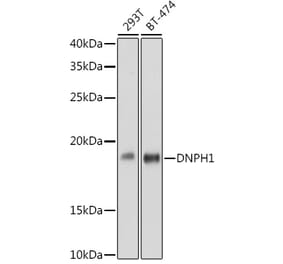 Western Blot - Anti-RCL Antibody [ARC2571] (A306605) - Antibodies.com