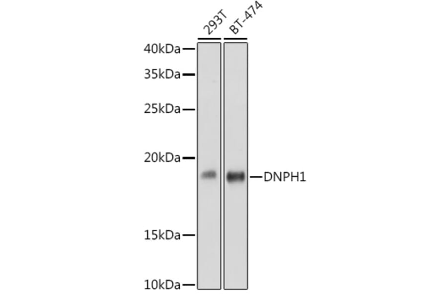 Western Blot - Anti-RCL Antibody [ARC2571] (A306605) - Antibodies.com