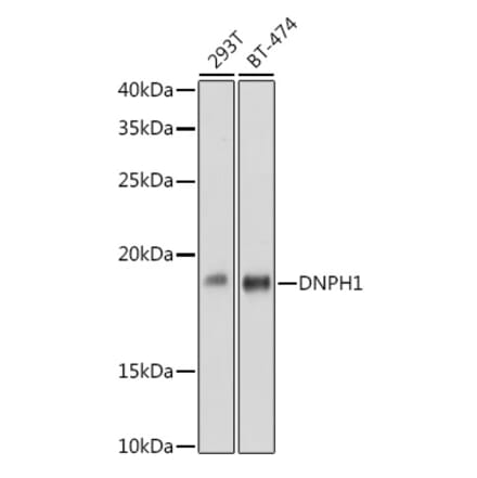 Western Blot - Anti-RCL Antibody [ARC2571] (A306605) - Antibodies.com