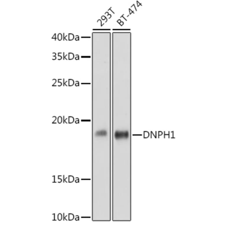 Western Blot - Anti-RCL Antibody [ARC2571] (A306605) - Antibodies.com