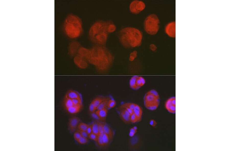 Immunofluorescence - Anti-RCL Antibody [ARC2571] (A306605) - Antibodies.com