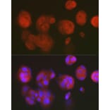 Immunofluorescence - Anti-RCL Antibody [ARC2571] (A306605) - Antibodies.com