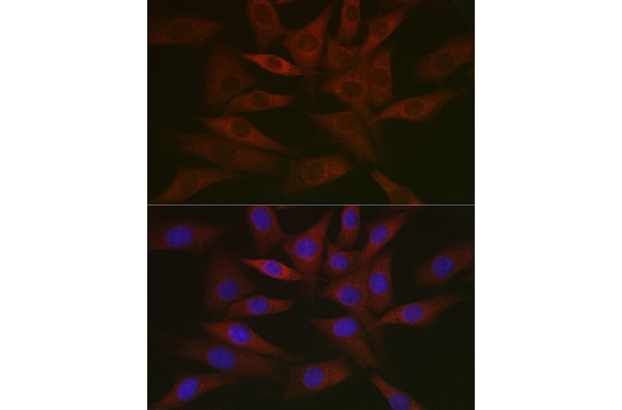 Immunofluorescence - Anti-RCL Antibody [ARC2571] (A306605) - Antibodies.com
