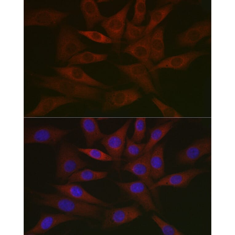 Immunofluorescence - Anti-RCL Antibody [ARC2571] (A306605) - Antibodies.com