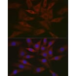 Immunofluorescence - Anti-RCL Antibody [ARC2571] (A306605) - Antibodies.com