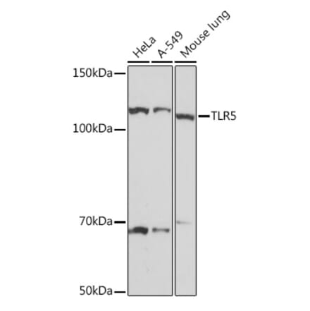 Western Blot - Anti-TLR5 Antibody [ARC1294] (A306606) - Antibodies.com