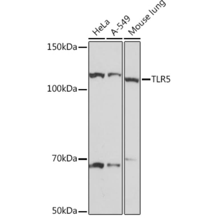 Western Blot - Anti-TLR5 Antibody [ARC1294] (A306606) - Antibodies.com