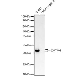 Western Blot - Anti-CMTM6 Antibody [ARC53656] (A306608) - Antibodies.com
