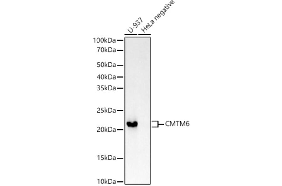 Western Blot - Anti-CMTM6 Antibody [ARC53656] (A306608) - Antibodies.com