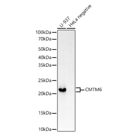 Western Blot - Anti-CMTM6 Antibody [ARC53656] (A306608) - Antibodies.com