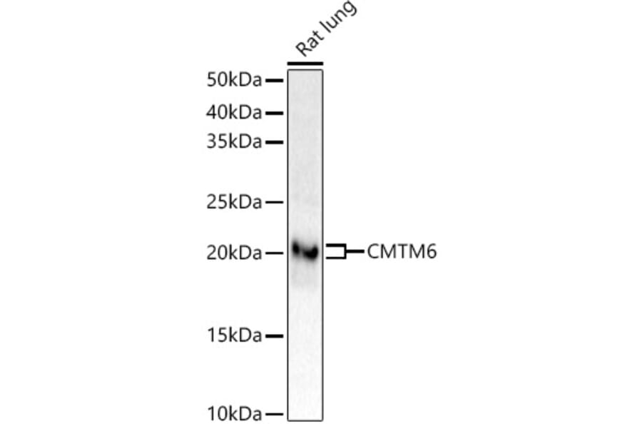 Western Blot - Anti-CMTM6 Antibody [ARC53656] (A306608) - Antibodies.com