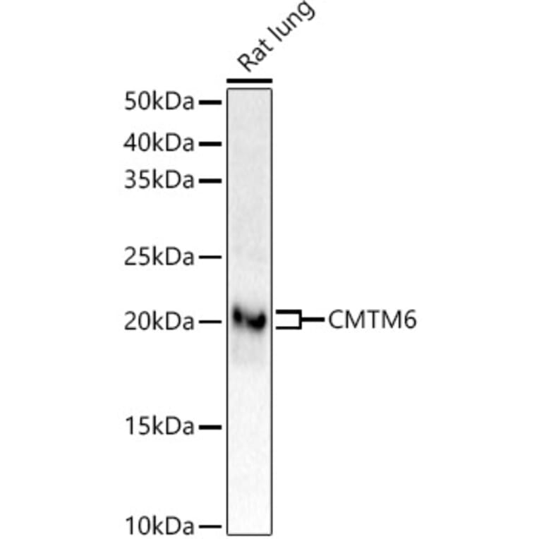 Western Blot - Anti-CMTM6 Antibody [ARC53656] (A306608) - Antibodies.com