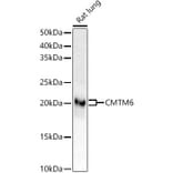 Western Blot - Anti-CMTM6 Antibody [ARC53656] (A306608) - Antibodies.com