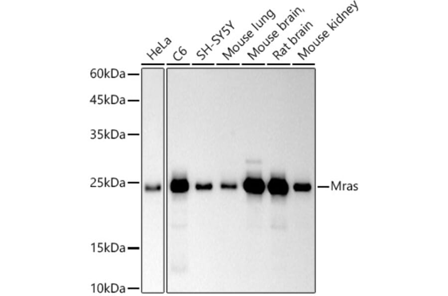 Western Blot - Anti-MRas Antibody [ARC2946] (A306609) - Antibodies.com
