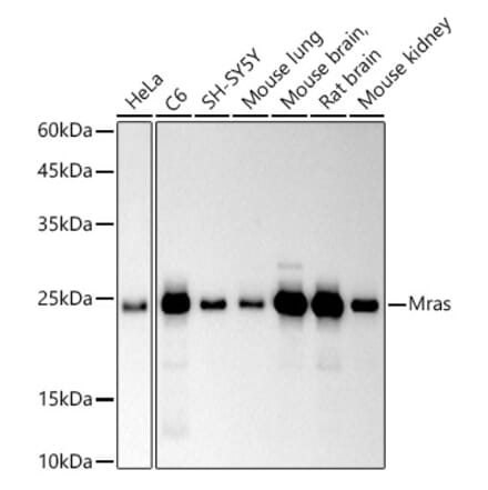 Western Blot - Anti-MRas Antibody [ARC2946] (A306609) - Antibodies.com