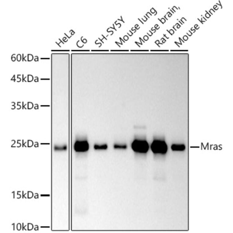 Western Blot - Anti-MRas Antibody [ARC2946] (A306609) - Antibodies.com