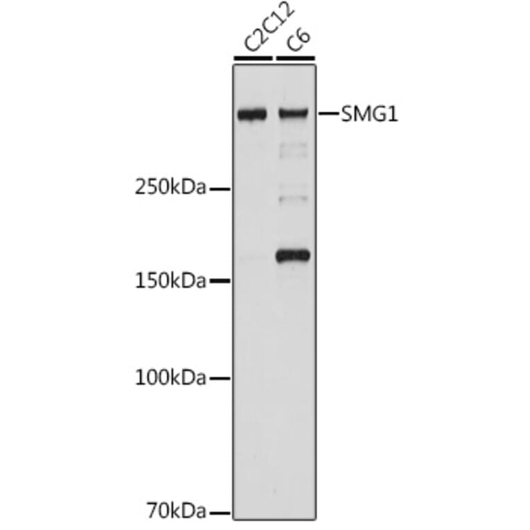 Western Blot - Anti-Smg1 Antibody [ARC2417] (A306610) - Antibodies.com