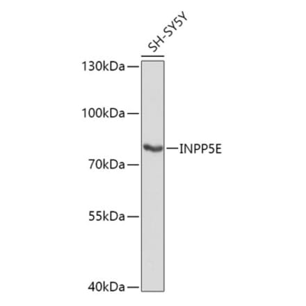 Western Blot - Anti-INPP5E Antibody (A306611) - Antibodies.com