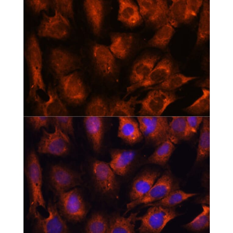 Immunofluorescence - Anti-INPP5E Antibody (A306611) - Antibodies.com