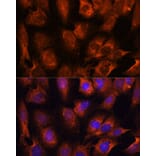 Immunofluorescence - Anti-INPP5E Antibody (A306611) - Antibodies.com