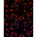 Immunofluorescence - Anti-INPP5E Antibody (A306611) - Antibodies.com
