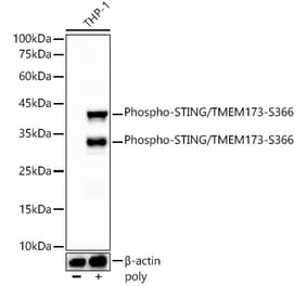 Western Blot - Anti-STING (phospho Ser366) Antibody [ARC57910] (A306612) - Antibodies.com