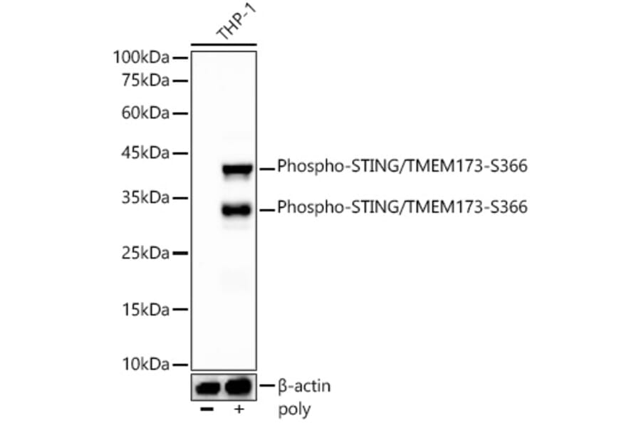 Western Blot - Anti-STING (phospho Ser366) Antibody [ARC57910] (A306612) - Antibodies.com