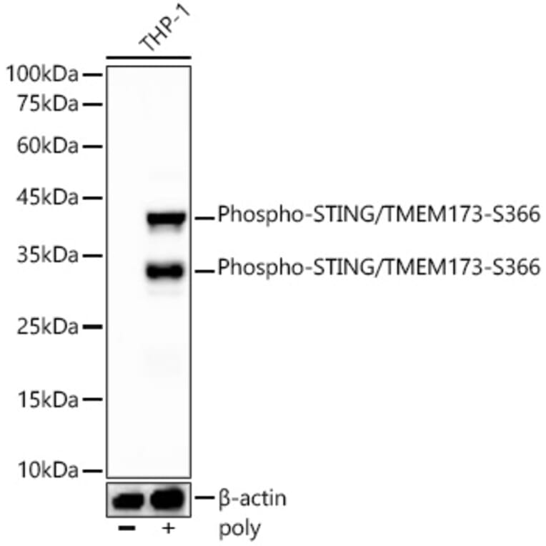 Western Blot - Anti-STING (phospho Ser366) Antibody [ARC57910] (A306612) - Antibodies.com