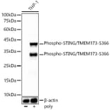 Western Blot - Anti-STING (phospho Ser366) Antibody [ARC57910] (A306612) - Antibodies.com