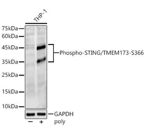 Western Blot - Anti-STING (phospho Ser366) Antibody (A306613) - Antibodies.com