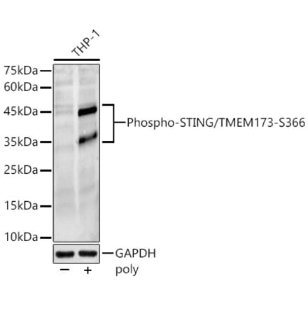 Western Blot - Anti-STING (phospho Ser366) Antibody (A306613) - Antibodies.com