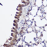 Immunohistochemistry - Anti-Abca8a Antibody (A306614) - Antibodies.com