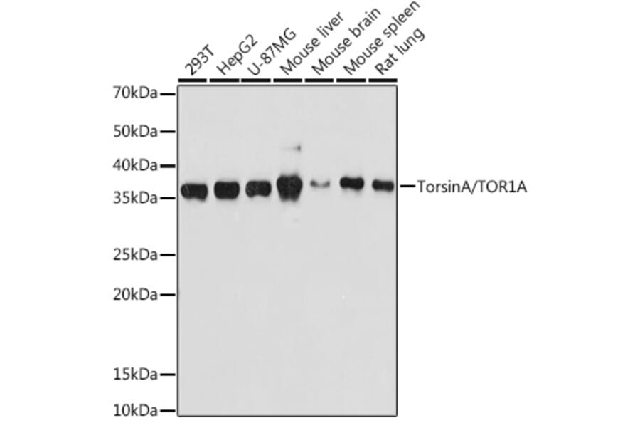 Western Blot - Anti-Torsin A/DYT1 Antibody [ARC1645] (A306615) - Antibodies.com