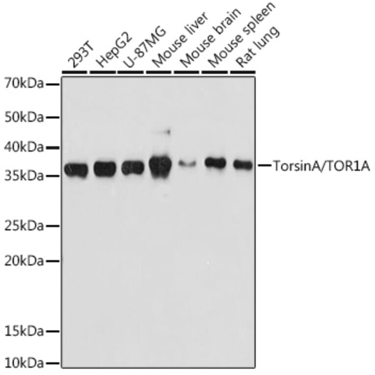 Western Blot - Anti-Torsin A/DYT1 Antibody [ARC1645] (A306615) - Antibodies.com