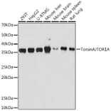 Western Blot - Anti-Torsin A/DYT1 Antibody [ARC1645] (A306615) - Antibodies.com