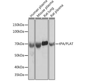 Western Blot - Anti-Tissue Plasminogen Activator Antibody [ARC0928] (A306616) - Antibodies.com